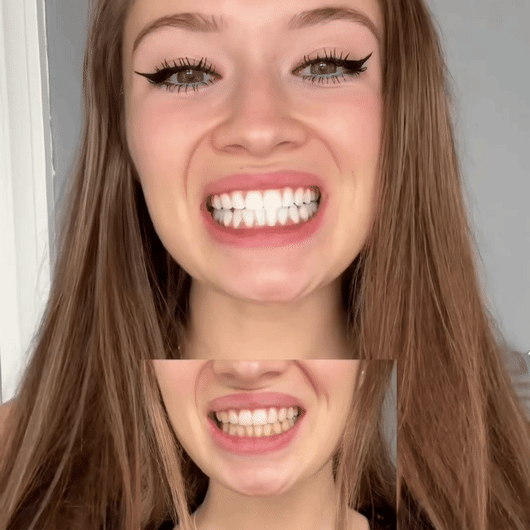 Xymera's Simply White Whitening Powder