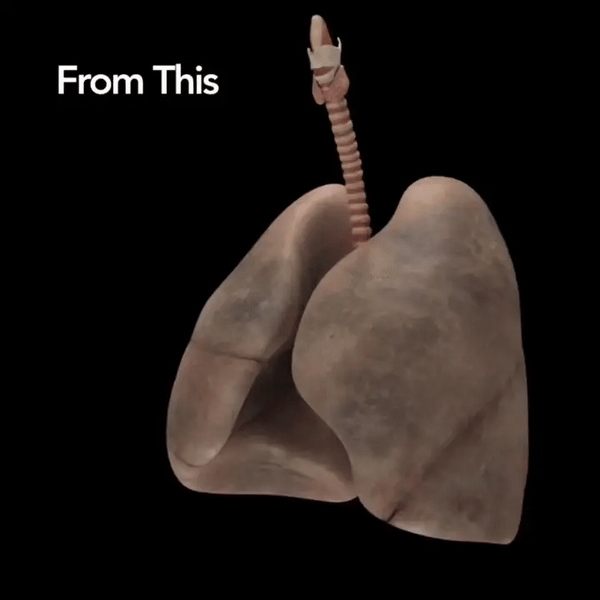 Airway Clearance Support