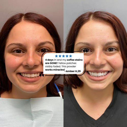 Simply White Whitening Powder