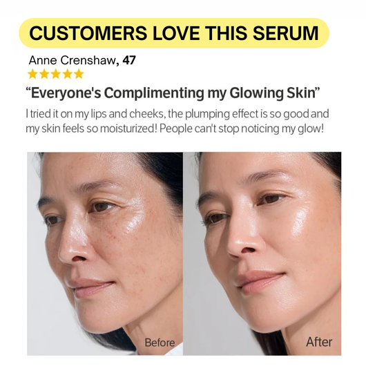 Xymera VoluLift™ Collagen Serum