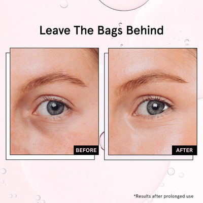 LumaBloom Eye Elixir