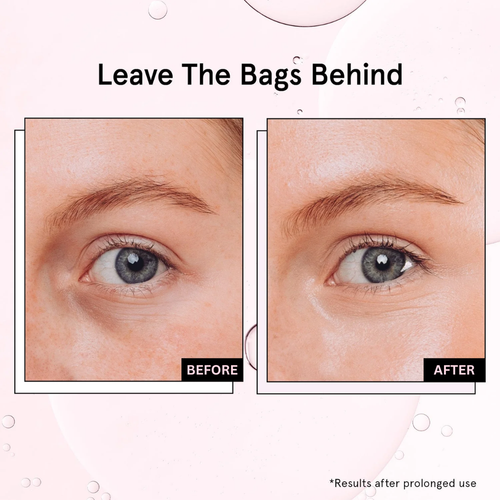 LumaBloom Eye Elixir