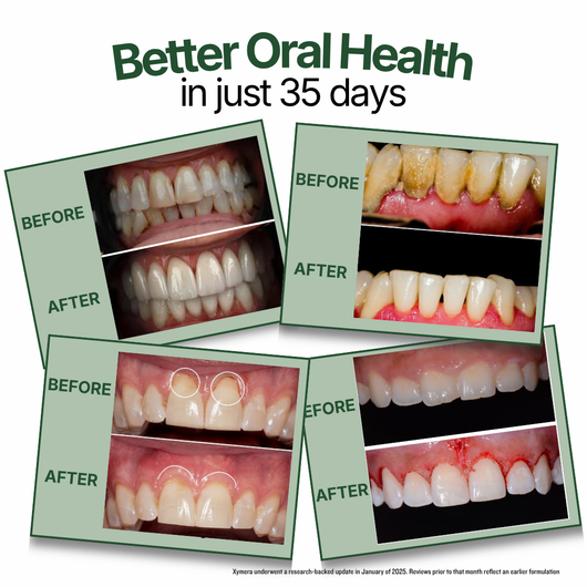 Oral Probiotics