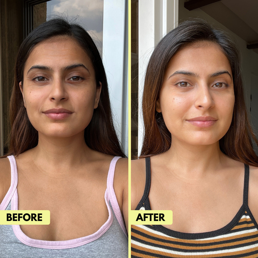 Xymera Lumora™ Retinal Booster