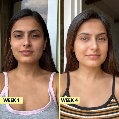 Xymera Lumora™ Retinal Booster