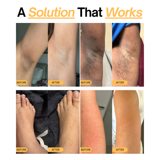 CelluClear™ Exfoliating Peel Shot