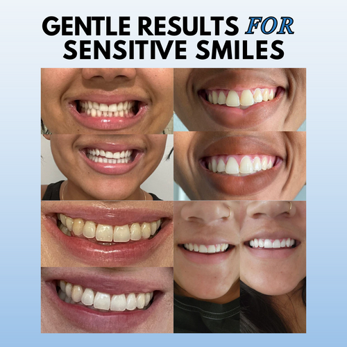 Simply White Whitening Powder