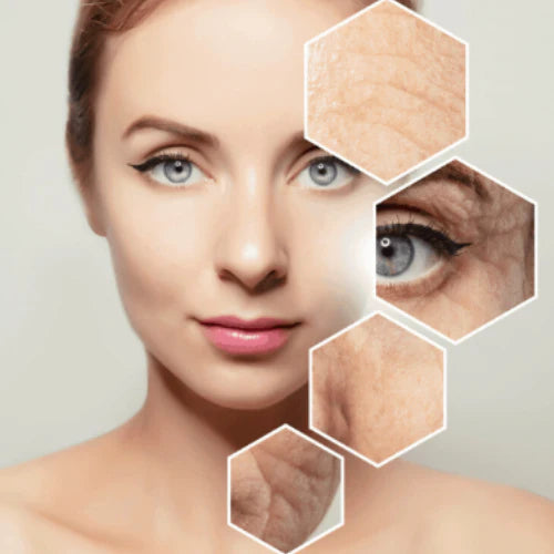 Improve Skin