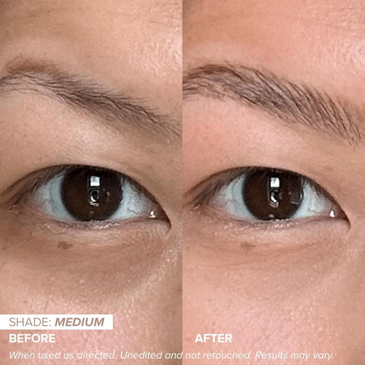 Xymera's Luminous Eye Corrector